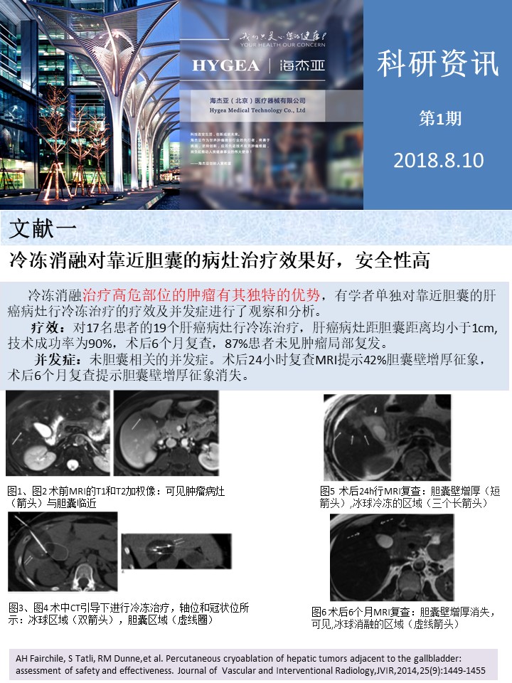 【海杰亞科研資訊】第1期——肝、肺癌消融